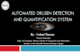 Automated drusen detection and quantificatioon system