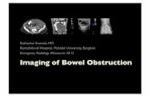 Imaging of Bowel Obstruction