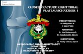 Closed Fracture Right Tibial Plateau Schatzker i