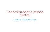 Coriorretinopatía Serosa Central