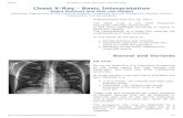 The Radiology Assistant : Chest X-Ray - Basic Interpretation