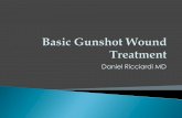Basic GSW Treatment
