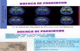 Doença de Parkinson.pdf