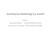 Gambaran Radiologi Ca Ovarii.pptx