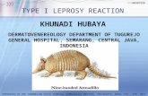 File Presentation Type i Leprosy Reaction Khunadi Hubaya