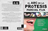 El ABC de La Protesis Parcial Fija