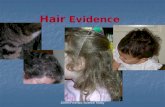 2009©Forensic Science Today Hair Evidence. 2009©Forensic Science Today Parts of the Hair Medulla Cuticle Cortex Follicle Root Distal end Proximal end.