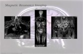 Background Image: pomeran/images/brainmri.jpg Magnetic Resonance Imaging  gy/images/breast-
