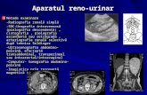 Aparatul reno-urinar Metode examinare -Radiografia renală simplă -SDC-Urografia intravenoasă (pielografia descendentă), cistografia, pielografia ascendentă.