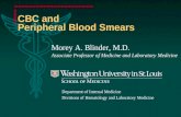 CBC and Peripheral Blood Smears Morey A. Blinder, M.D. Associate Professor of Medicine and Laboratory Medicine Department of Internal Medicine Divisions.