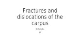 Fractures and dislocations of the carpus By Gatobu 6A