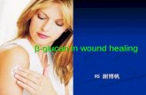 ’-glucan in wound healing Ri è¬‌¸† Ri è¬‌¸†. Wound healing