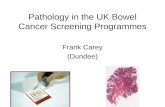Pathology in the UK Bowel Cancer Screening Programmes Frank Carey (Dundee)