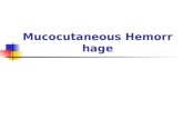 Mucocutaneous Hemorrhage. Definition Mucocutaneous hemorrhage is caused by the abnormalities of hemostasis( 止血 ) and /or coagulation( 凝血 ), characterized.