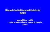 Slipped Capital Femoral Epiphysis SCFE دکتر مظلومی دانشیار ارتوپدی دانشگاه علوم پزشکی مشهد.