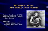 Methamphetamine: Who Really Gets Burned Nathan Kemalyan, MD FACS Medical Director, Oregon Burn Center Credits: Kelli Salter, M.D. Surgical Resident, OHSU.