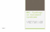 MRI findings in Kallmann syndrome H. ZAGHOUANI BEN ALAYA, Z. ACHOUR, M.BHOURI, M. LIMEME, S. MAJDOUB, H. AMARA, D. BAKIR, CH. KRAIEM HN27.