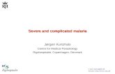 E-mail: jkcmp@rh.dk Internet:  Severe and complicated malaria Jørgen Kurtzhals Centre for Medical Parasitology Rigshospitalet, Copenhagen,