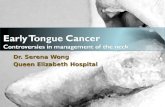 Early Tongue Cancer Controversies in management of the neck Dr. Serena Wong Queen Elizabeth Hospital.
