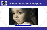 Child Abuse and Neglect. Reporting Abuse & Neglect FL Abuse Hotline Established in 1971 Receives reports of abuse or neglect 24/7 and immediately initiates.