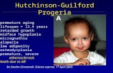 Hutchinson-Guilford Progeria -premature aging -lifespan = 13.4 years -retarded growth -midface hypoplasia -micrognathia -alopecia -low adiposity -osteodysplasia.