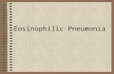 Eosinophilic Pneumonia. Or Churg-Strauss Syndrome?