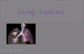 Bio 218, Fall 2012-52999. 1. Lung Cancer Summary 2. Types of Lung Cancer 3. Types of Lung Cancer continued 4.Diagnostic Imaging 5.Risk Factors 6.Symptoms.