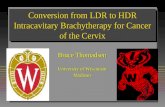 Conversion from LDR to HDR Intracavitary Brachytherapy for Cancer of the Cervix Bruce Thomadsen University of Wisconsin Madison.