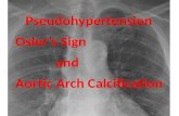 Pseudohypertension Osler’s Sign and Aortic Arch Calcification.