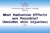 International Atomic Energy Agency What Radiation Effects are Possible? (besides skin injuries) L3.