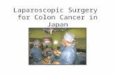 Laparoscopic Surgery for Colon Cancer in Japan. JSCCR Guidelines Laparoscopic surgery Criteria: stage 0 /stage I colon/rectsigmoid cancer Stage II/stage.