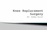 BY: Robby Rusch.  Surgical procedure in which the diseased part of the knee is replaced  Replaced with artificial substances  Can be partial or total.