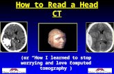 How to Read a Head CT (or “How I learned to stop worrying and love computed tomography”)