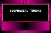 ESOPHAGEAL TUMORS.. Eso tumors: u Malignant > common than benign. u Unfortunately, eso cancer discovered late & overall 5 y ear prognosis is bad < 10.