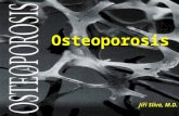 Osteoporosis Jiří Slíva, M.D.. Osteoporosis §a bone disease that is characterized by progressive loss of bone density and thinning of bone tissue §higher.