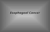 Esophageal Cancer. usually not detected until it has progressed to an advanced incurable stage. Cancer of the esophagus remains a devastating disease.