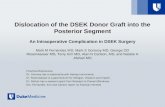 Dislocation of the DSEK Donor Graft into the Posterior Segment An Intraoperative Complication in DSEK Surgery Mark M Fernandez MD, Mark S Gorovoy MD, George.