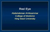 Red Eye Abdulrahman Al-Muammar College of Medicine King Saud University.