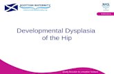Quality Education for a Healthier Scotland Multidisciplinary Developmental Dysplasia of the Hip.