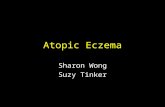 Atopic Eczema Sharon Wong Suzy Tinker. Classification EndogenousvsExogenous Acute vsChronic.