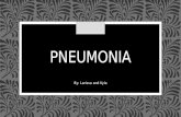 PNEUMONIA By: Larissa and Kyla. What is Pneumonia? Inflammation of the lung; an infectious disease - caused by bacteria or a virus Pneumonia can target: