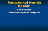 Parastomal Hernia Repair Parastomal Hernia Repair C R Kapadia Airedale General Hospital.