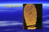 Fingerprints. Outline  Individuality of Fingerprints  What are fingerprints?  Classification of fingerprint patterns  AFIS  Methods of detecting.