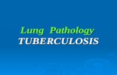 Lung Pathology TUBERCULOSIS. TUBERCULOSIS Definition: Chronic infective granuloma caused by tubercle bacilli Causative organism:  Two types of bacilli.