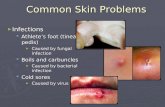 Common Skin Problems ► Infections  Athlete’s foot (tinea pedis) ► Caused by fungal infection  Boils and carbuncles ► Caused by bacterial infection