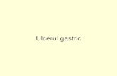 Ulcerul gastric. Definitie:ulcerul este boala caracterizata prin aparitia la nivelul stomacului sau a duodenului a unei leziuni ulceroase.