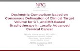 Dosimetric Comparison based on Consensus Delineation of Clinical Target Volume for CT- and MR-Based Brachytherapy in Locally Advanced Cervical Cancer Akila.