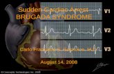 Sudden Cardiac Arrest BRUGADA SYNDROME Carlo Francisco S. Gochuico, M.D. August 14, 2008.