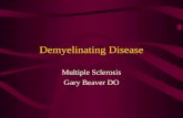Demyelinating Disease Multiple Sclerosis Gary Beaver DO.