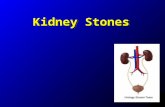 Kidney Stones. EpidemiologyEpidemiology Bladder and kidney stones detected in Egyptian mummies dating back to 4800 BC Bladder and kidney stones detected